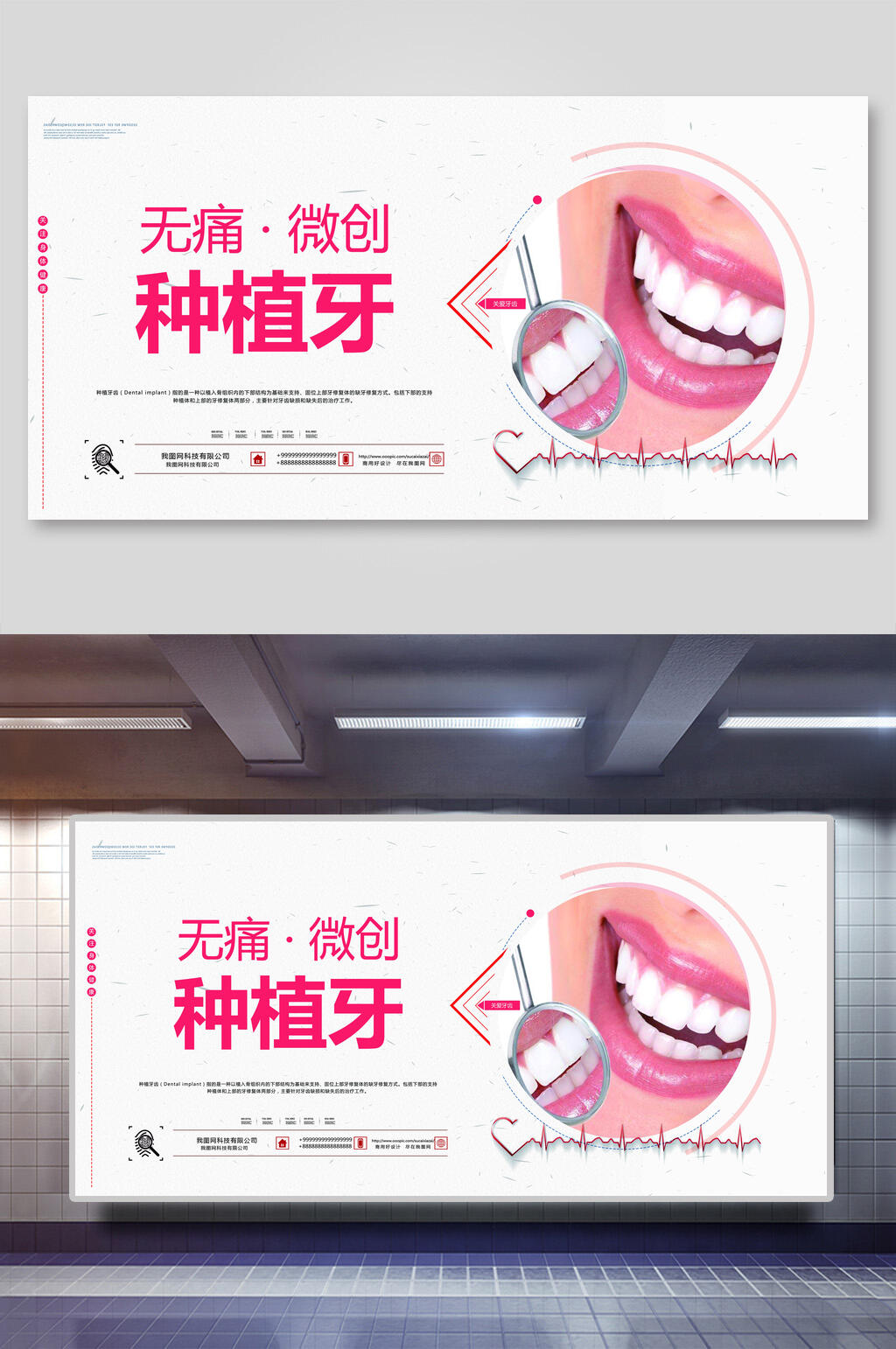 无痛微创齿海报设计展板 美牙素材