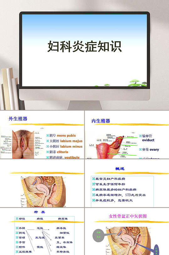 妇科疾病妇科炎症ppt模板