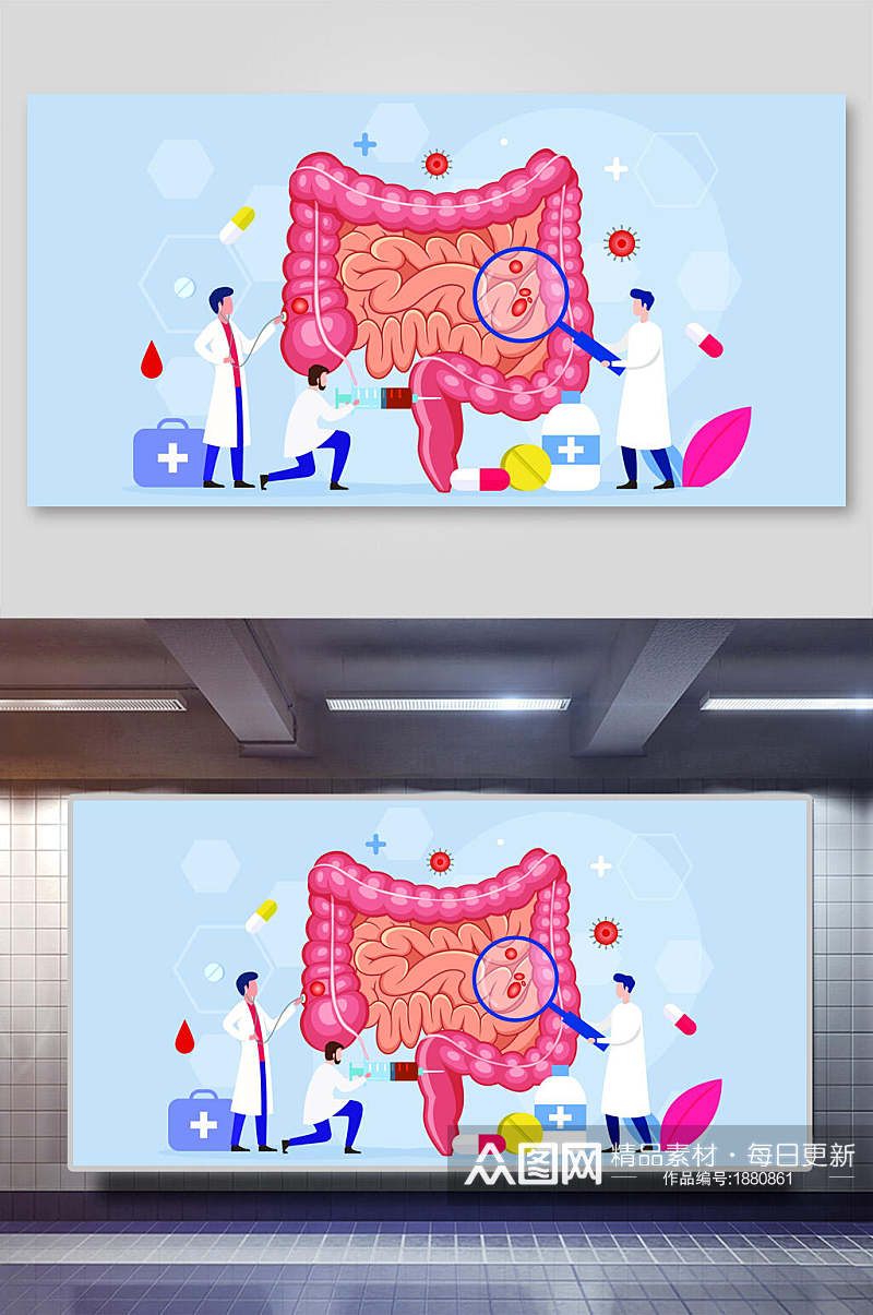 人体器官大小肠道检查医疗插画素材