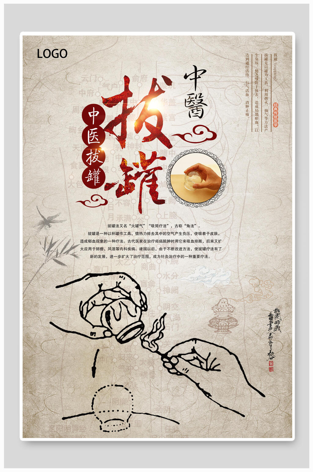 灰色中医拔罐养生海报 展板素材
