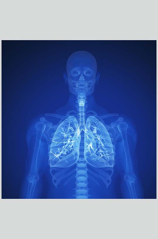 人体x光器官图片