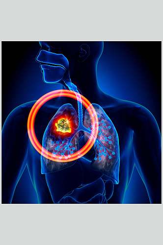 人体器官肺模拟图片