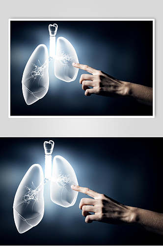 人体器官肺图片