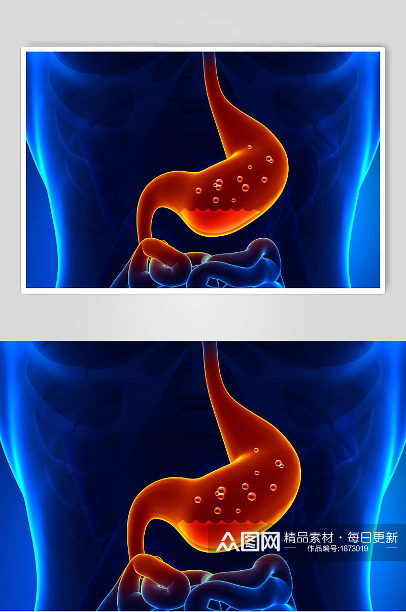真实人体器官胃图片素材