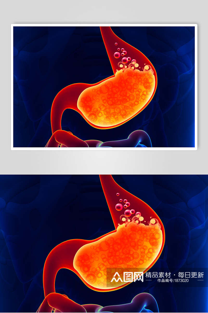 人体器官胃图片素材