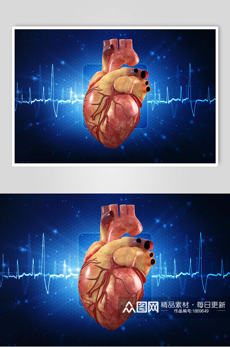 人体器官心脏图片素材