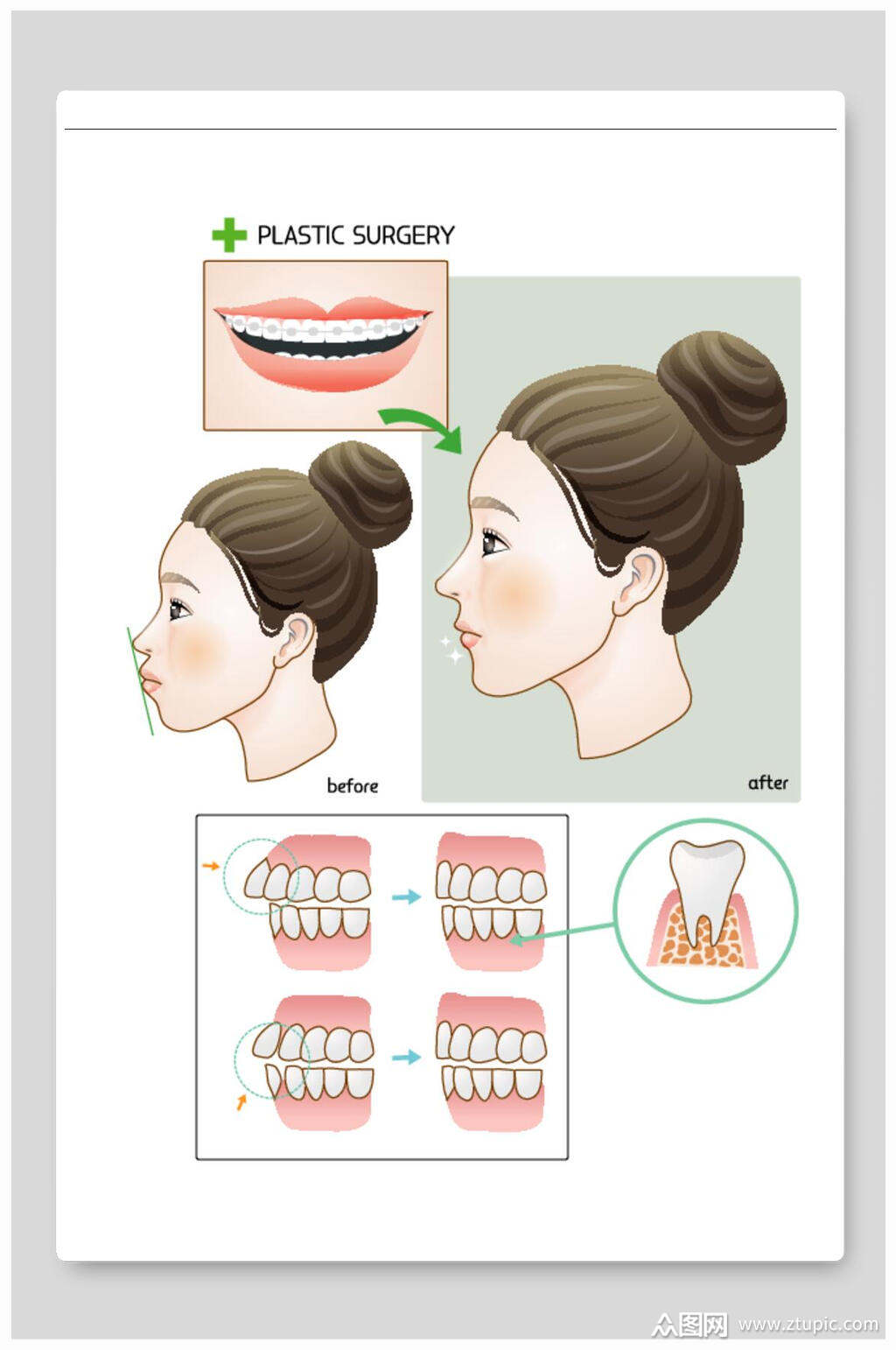 医美整形矢量素材牙齿矫正素材