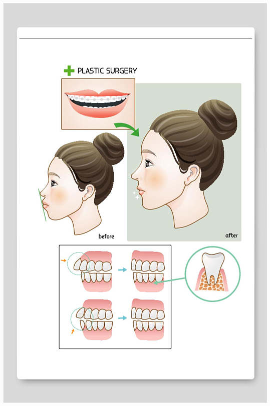 医美整形矢量素材牙齿矫正