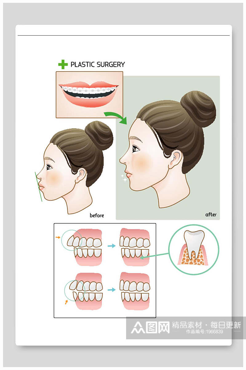 医美整形矢量素材牙齿矫正素材