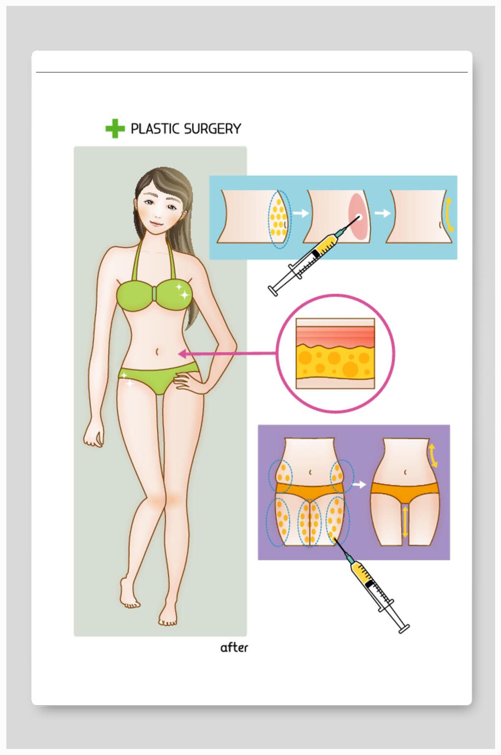 医美整形矢量素材收腰抽纸瘦腿素材