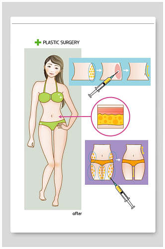 医美整形矢量素材收腰抽纸瘦腿