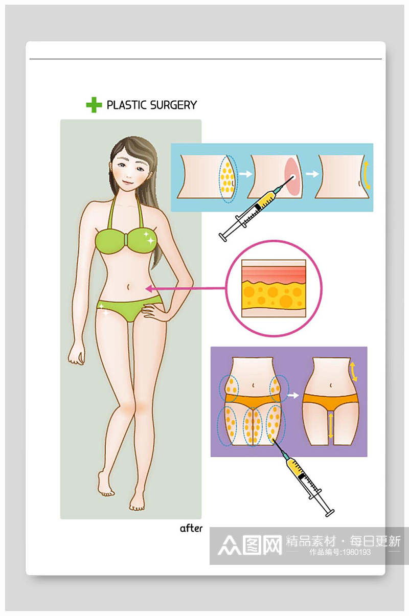 医美整形矢量素材收腰抽纸瘦腿素材