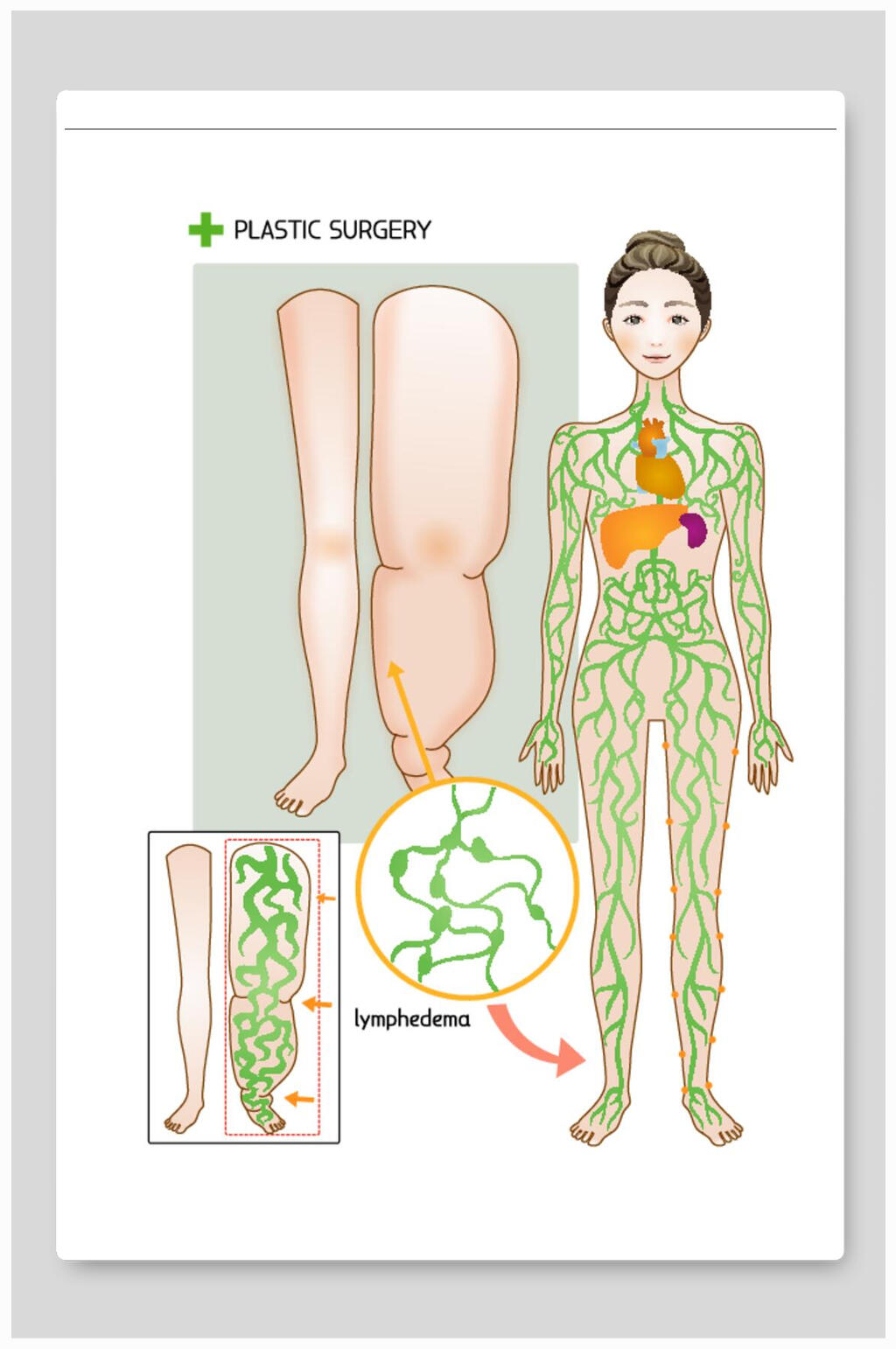 医美整形矢量素材医院腿部抽脂瘦腿素材