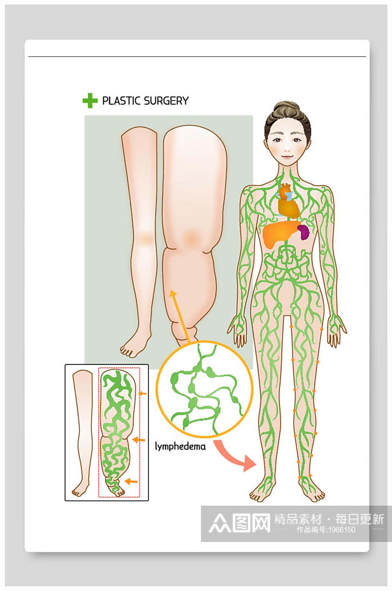 医美整形矢量素材医院腿部抽脂瘦腿素材