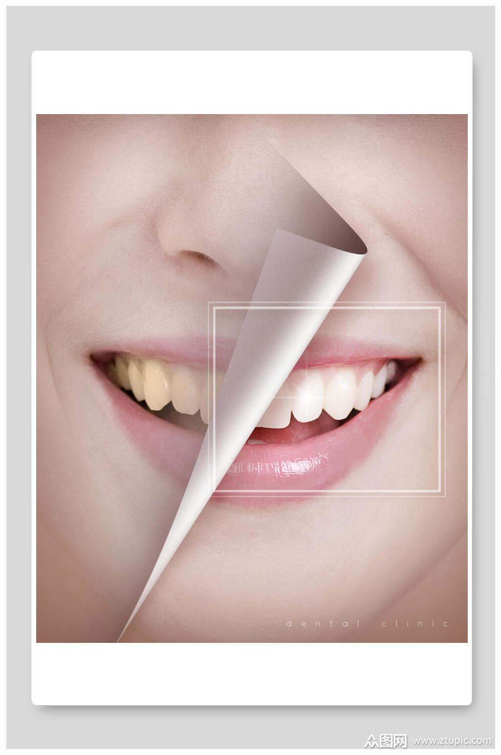 大气绚烂美白牙科背景素材