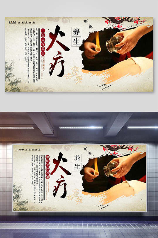 火疗拔罐 中医养生展板
