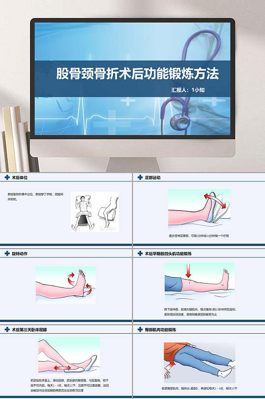 股骨颈骨折功能锻炼方法术后护理ppt