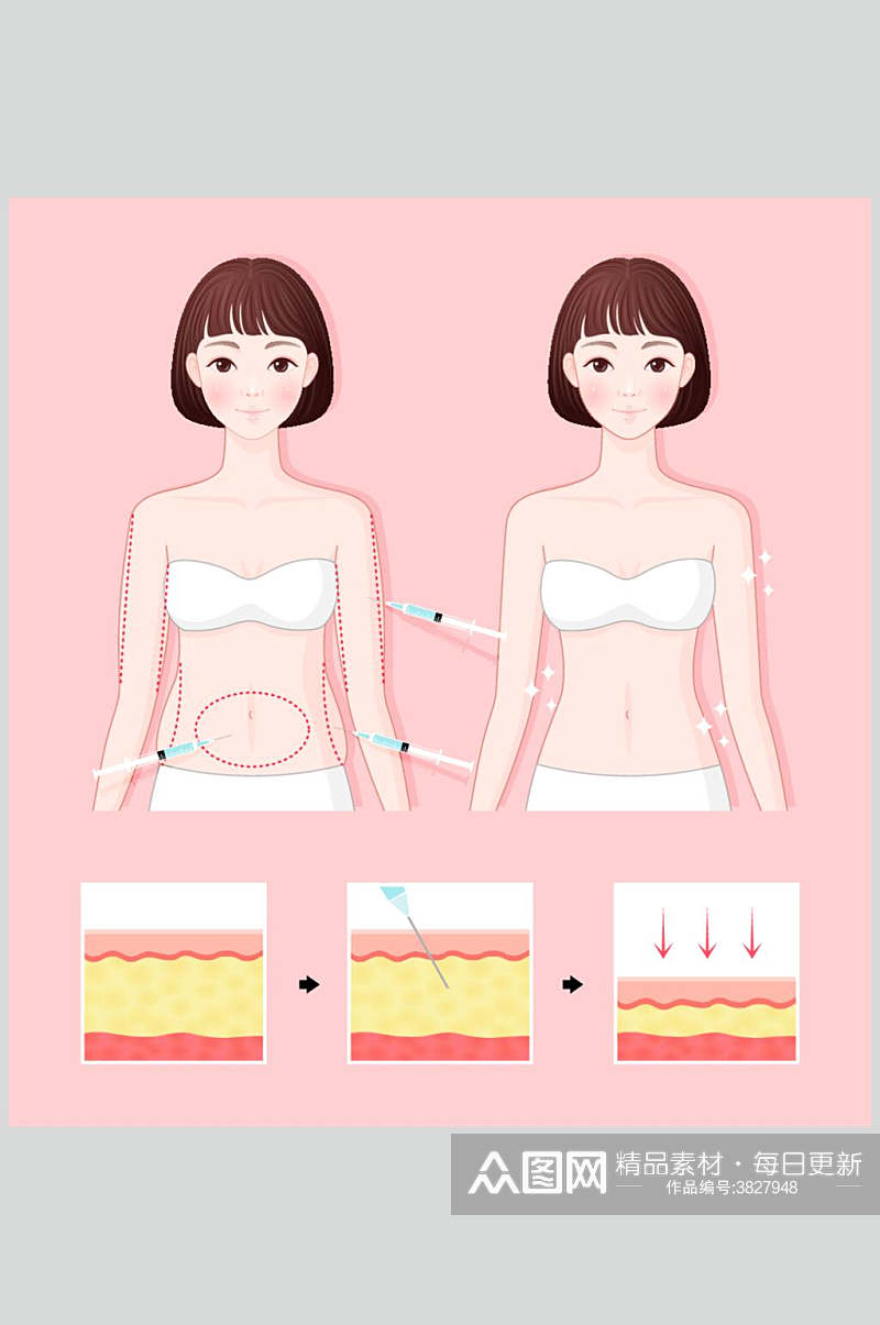 脂肪整形整容矢量素材素材