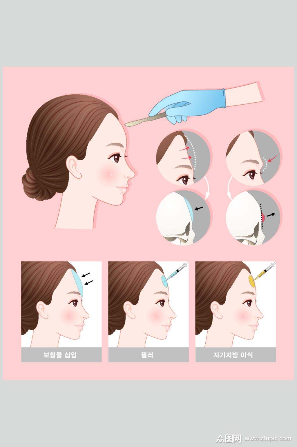 众图网独家提供侧脸粉色高端创意整形整容矢量素材素材免费下载,本