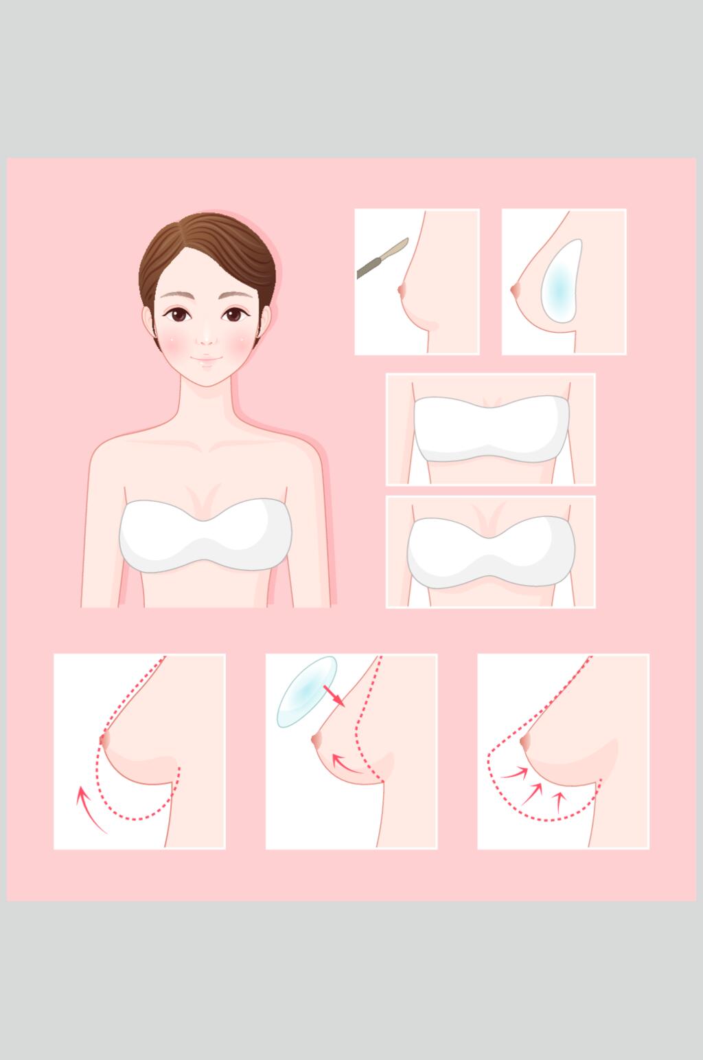 粉色手绘创意丰胸整形整容矢量素材素材