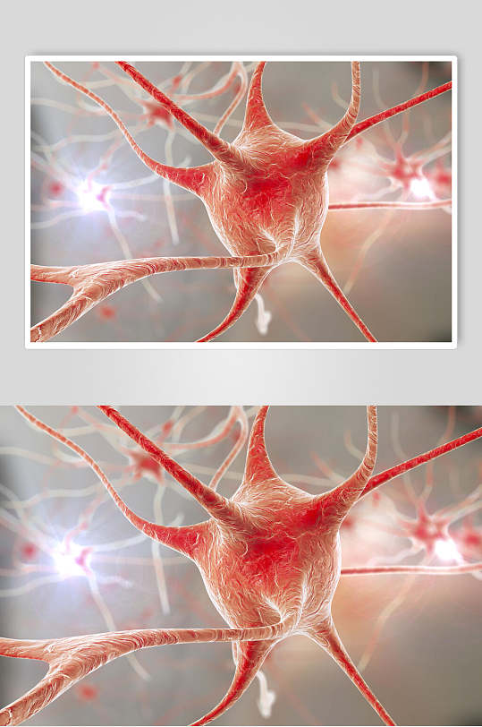脑细胞细胞病菌图片