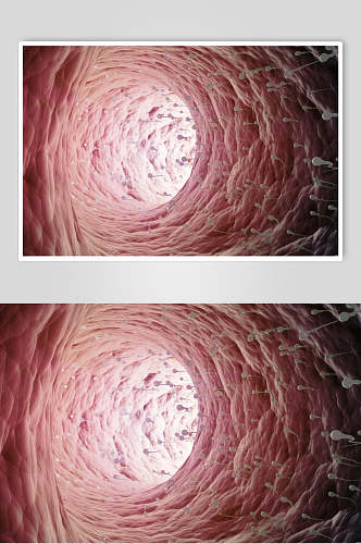 血管壁细胞病菌图片