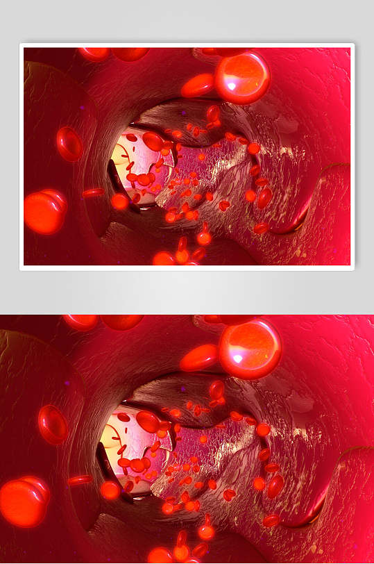 细小红色细胞病菌图片