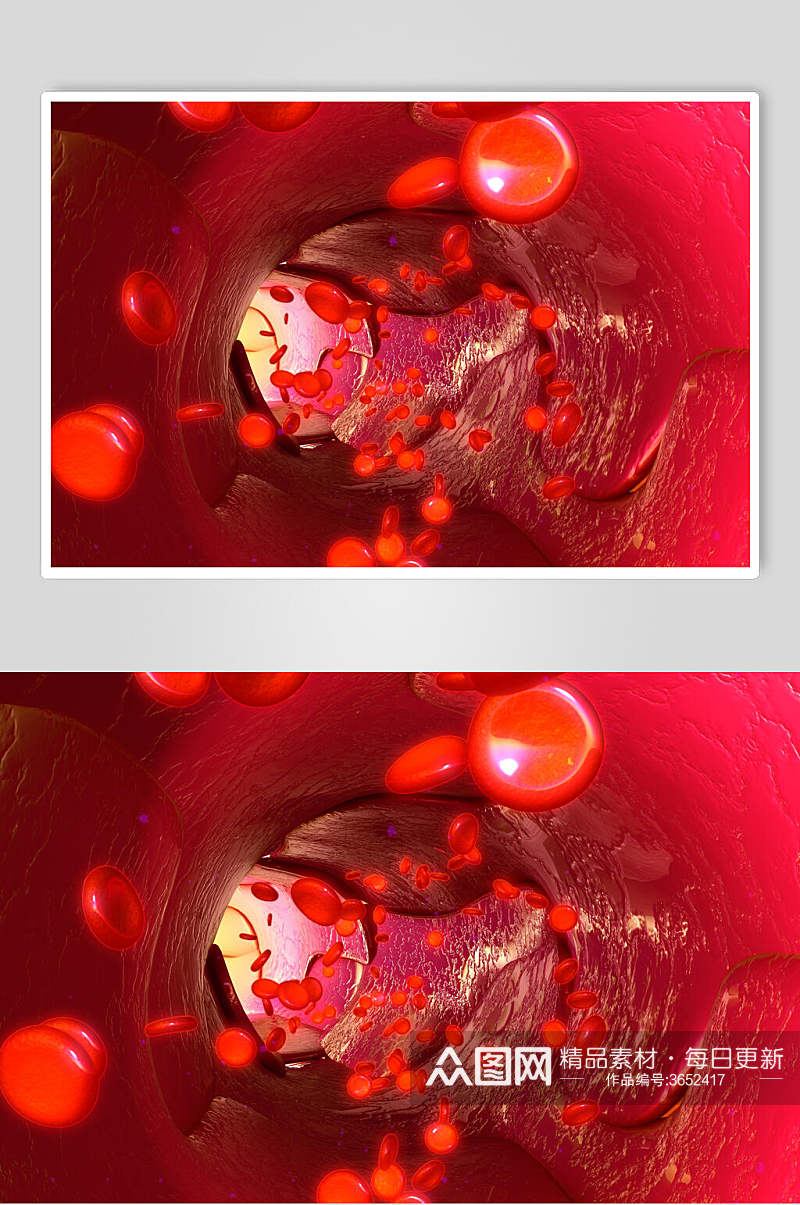 细小红色细胞病菌图片素材