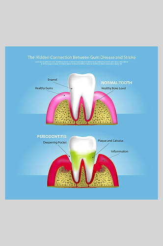 创意大气牙齿植牙矢量图解插画