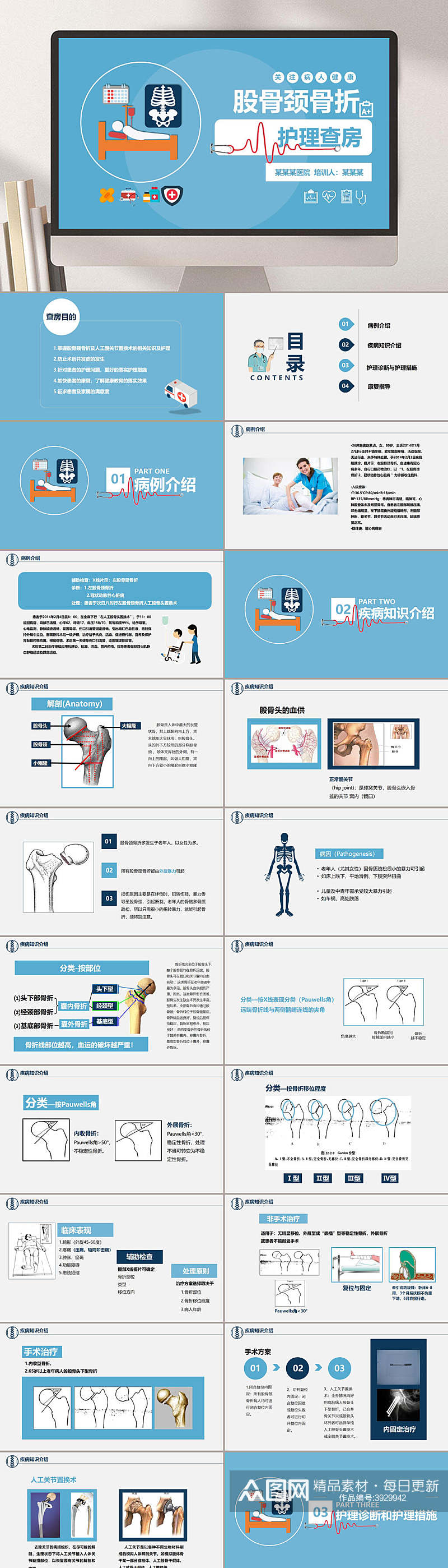 蓝色简约风医学股骨颈骨折护理查房PPT素材