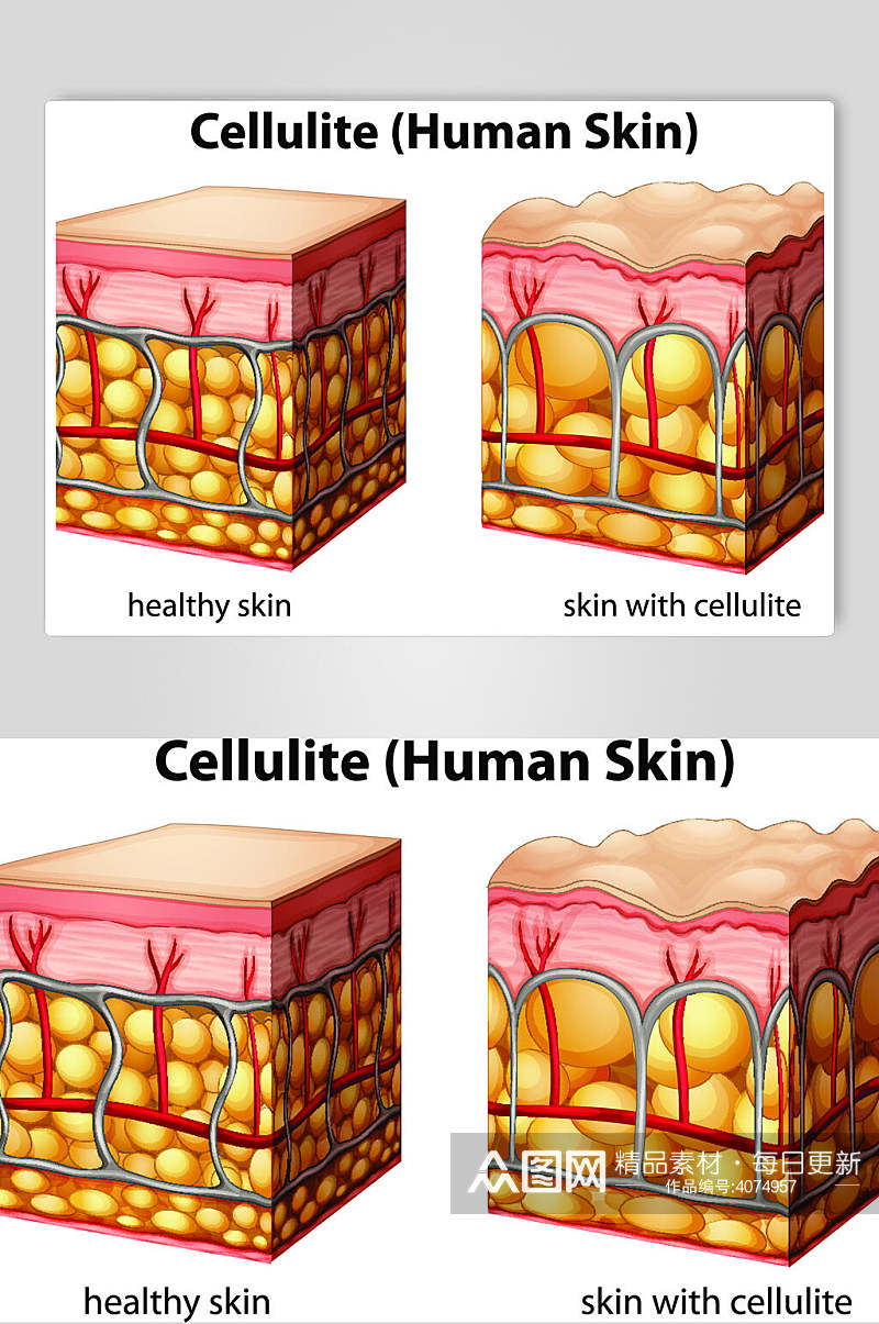 皮肤医疗医学人体解剖矢量素材素材