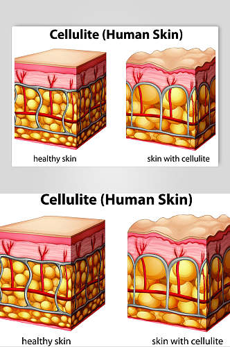皮肤医疗医学人体解剖矢量素材