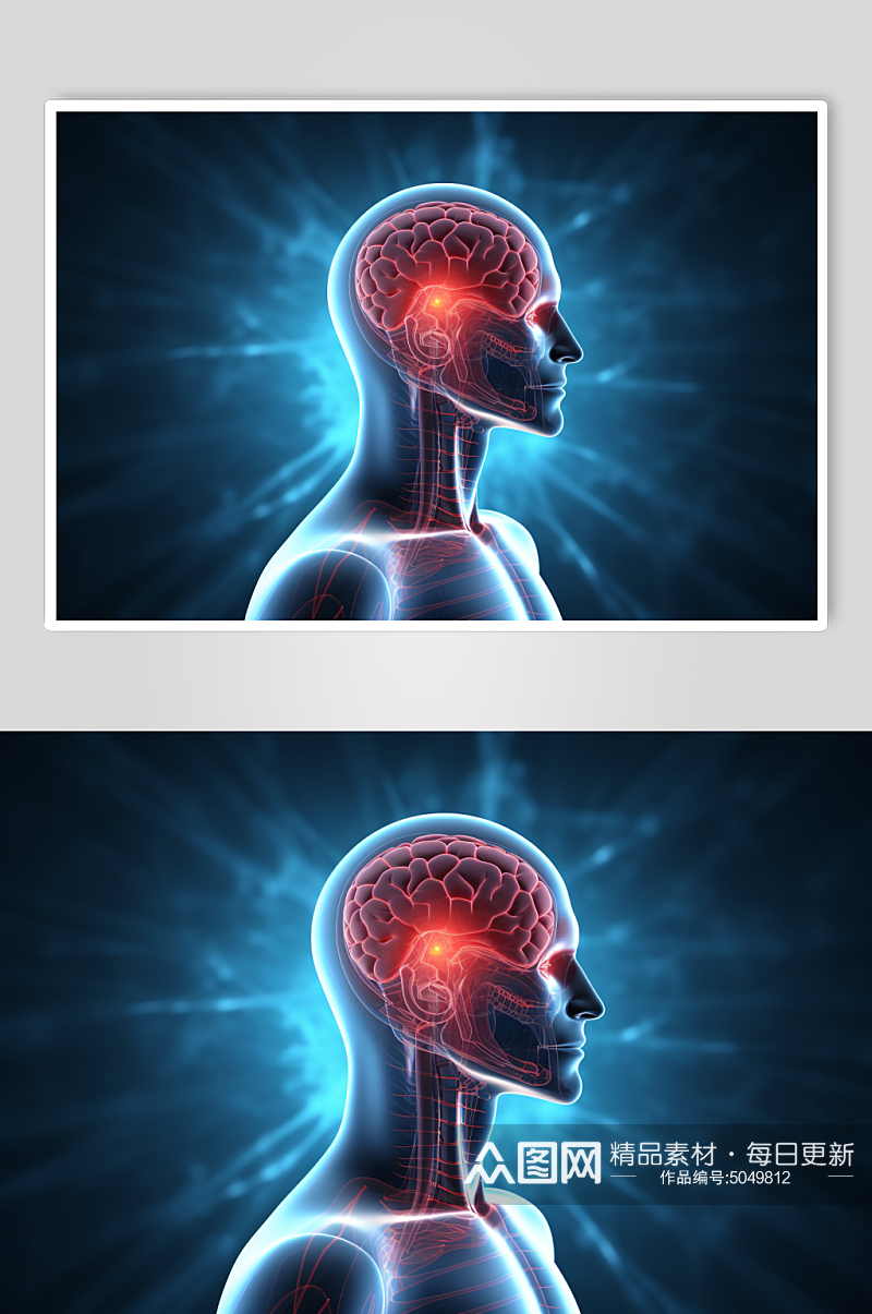 AI数字艺术医疗大脑图片素材