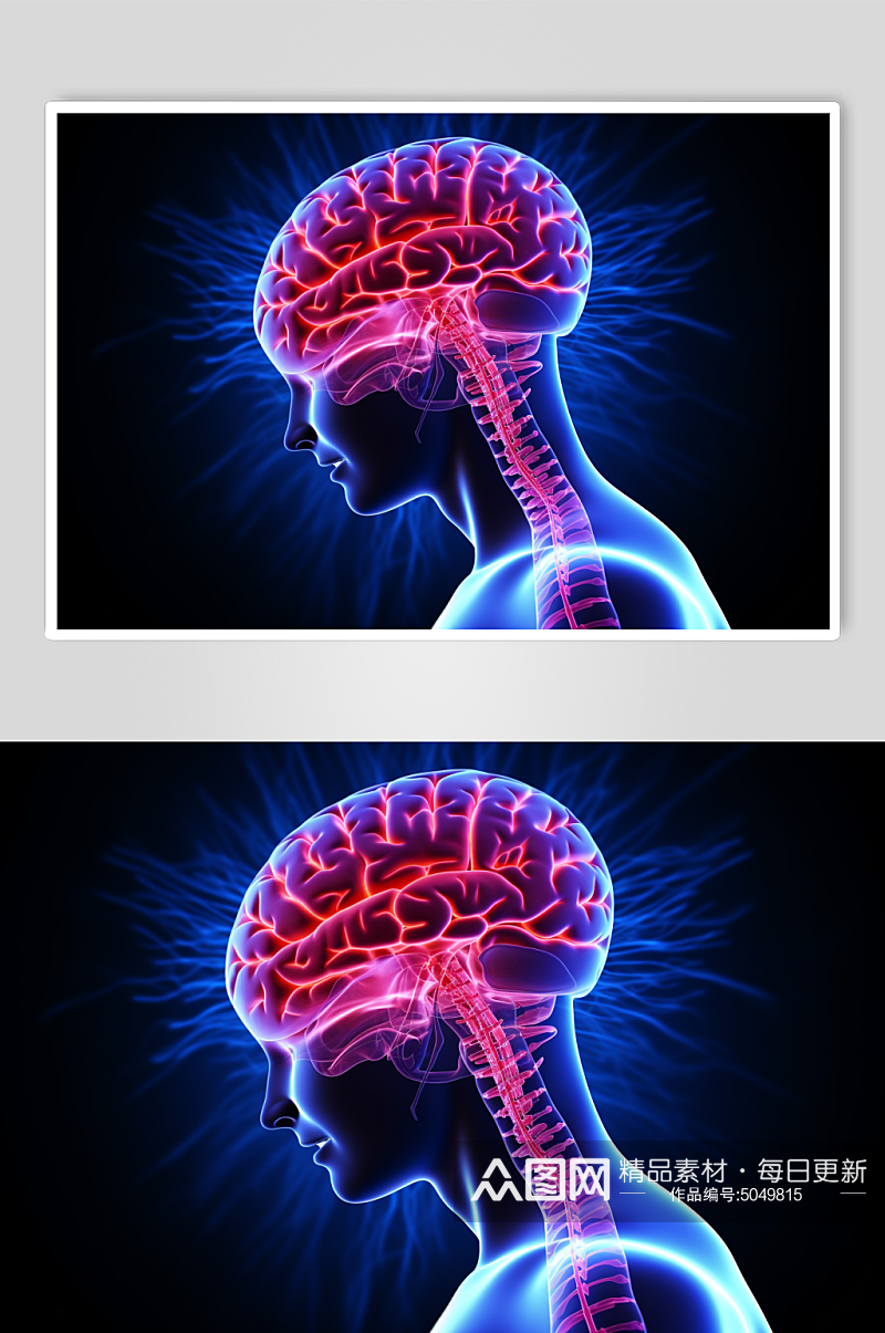 AI数字艺术医疗大脑图片素材