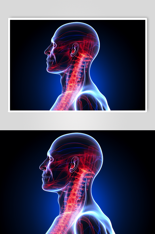AI数字艺术医疗颈椎病图片
