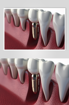AI数字艺术医疗牙齿模型