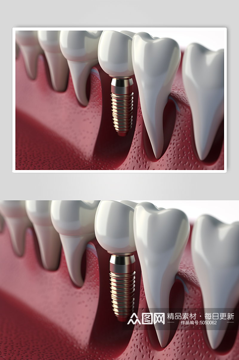 AI数字艺术医疗牙齿模型素材