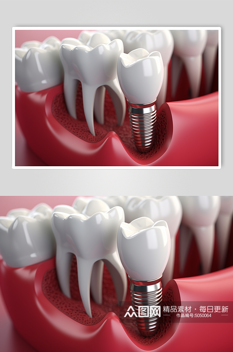AI数字艺术医疗牙齿模型素材