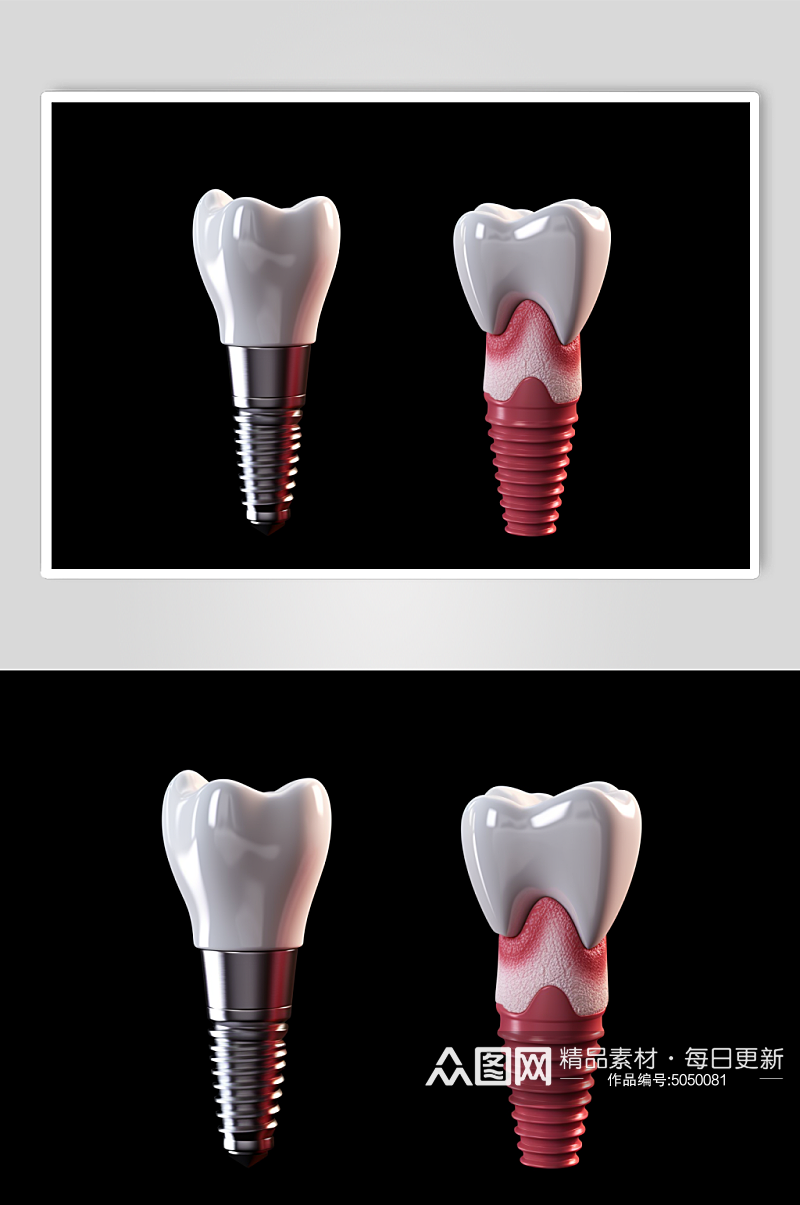 AI数字艺术医疗牙齿模型素材