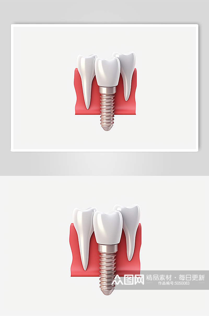 AI数字艺术医疗牙齿模型素材