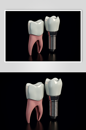 AI数字艺术医疗牙齿模型