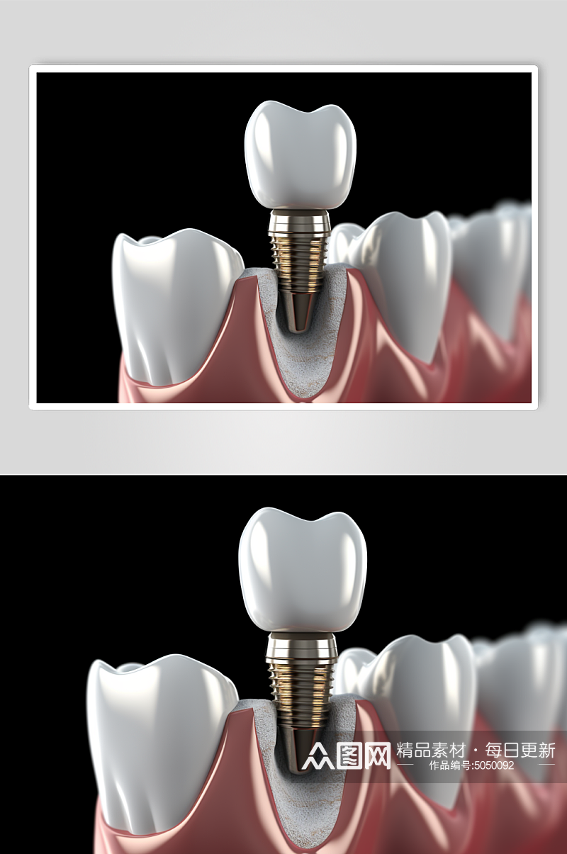 AI数字艺术医疗牙齿模型素材