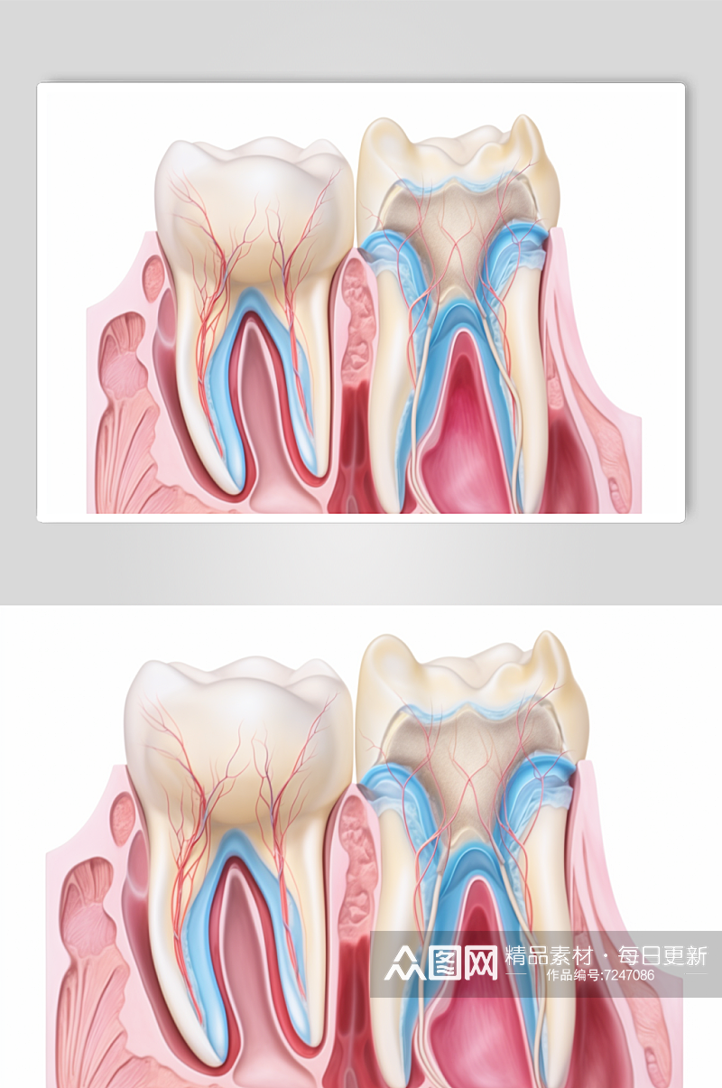 AI数字艺术卡通牙科牙齿内部结构插画素材