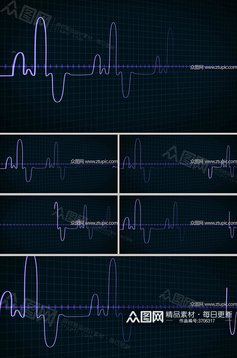 心脏速率显示器医疗研究观察素材