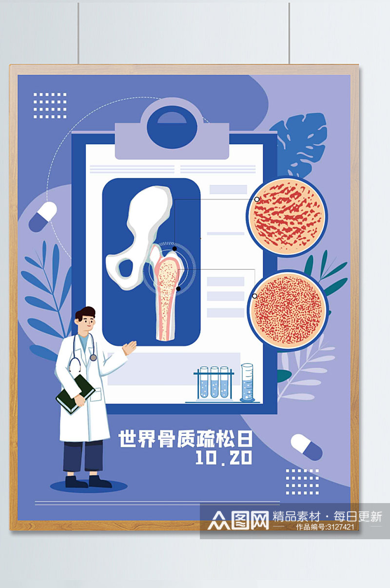 世界骨质疏松日病例展示效果医疗健康海报素材
