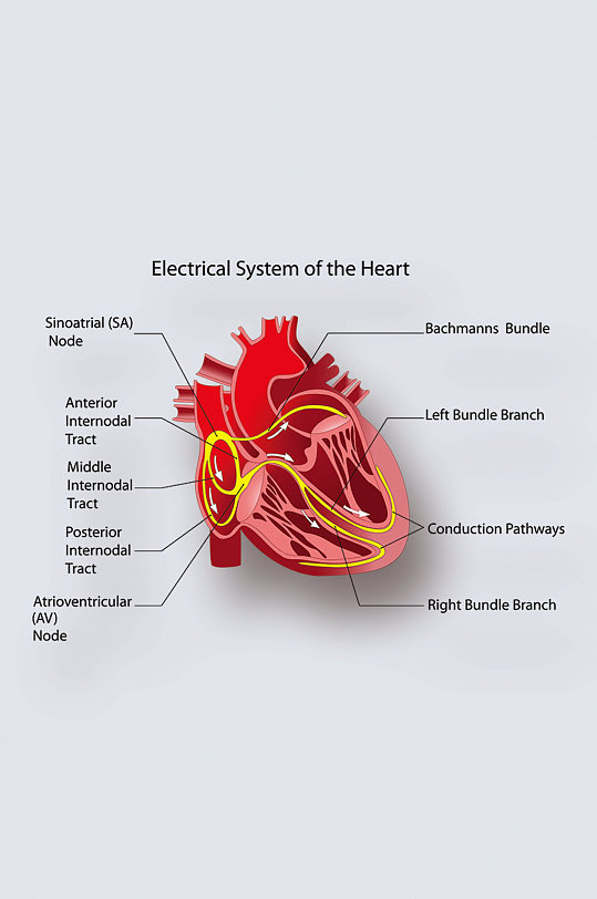 人体心肌系统病症解析图医学器官解剖插图