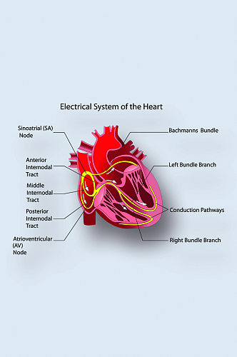 人体心肌系统病症解析图医学器官解剖插图