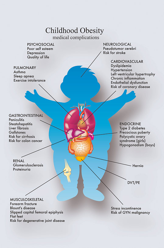 儿童肥胖病症解析图医学器官解剖插图