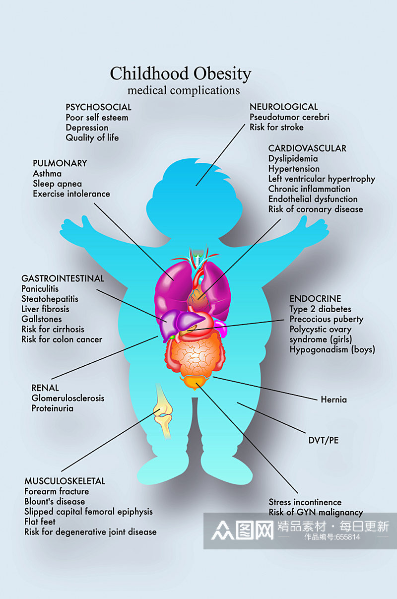 儿童肥胖病症解析图医学器官解剖插图素材