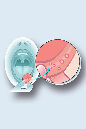 嘴唇感染病症解析图医学器官解剖插图